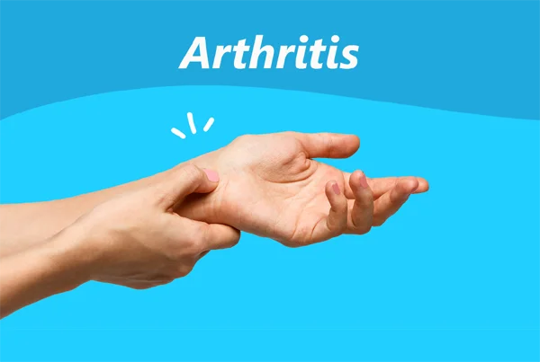 Arthritis